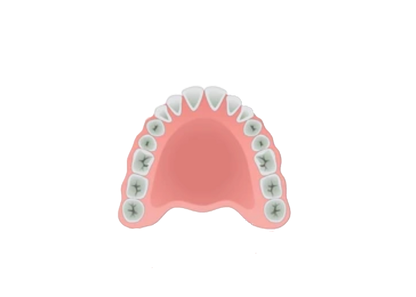 Denture Try In