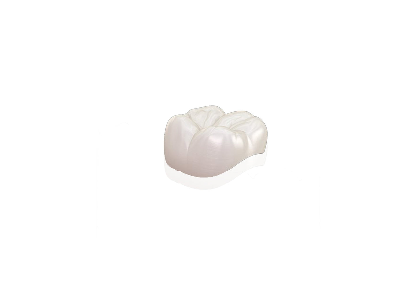 Zirconia with porcelain Layering