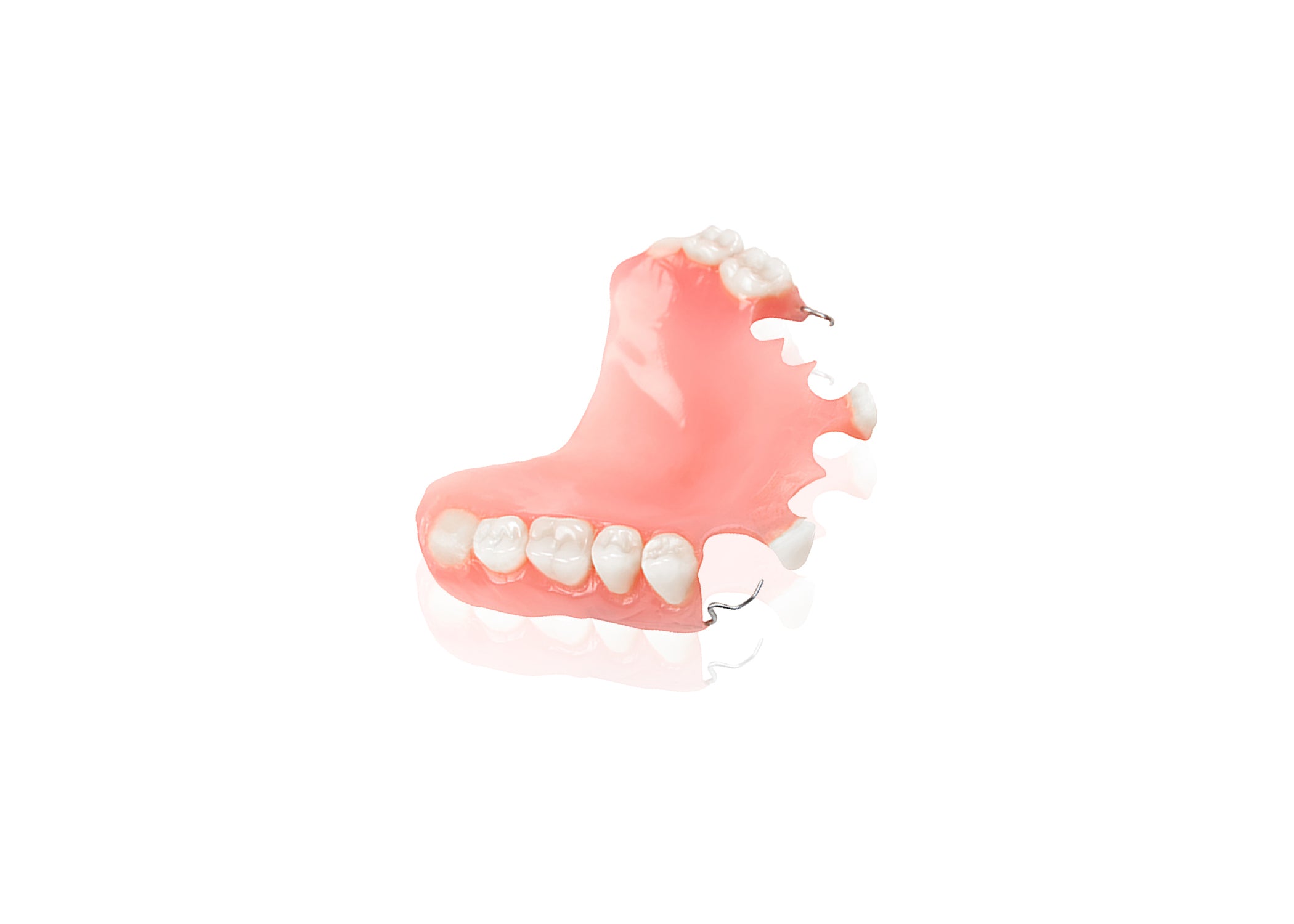 Stayplate (1-6 teeth) – Creative Dental Industries