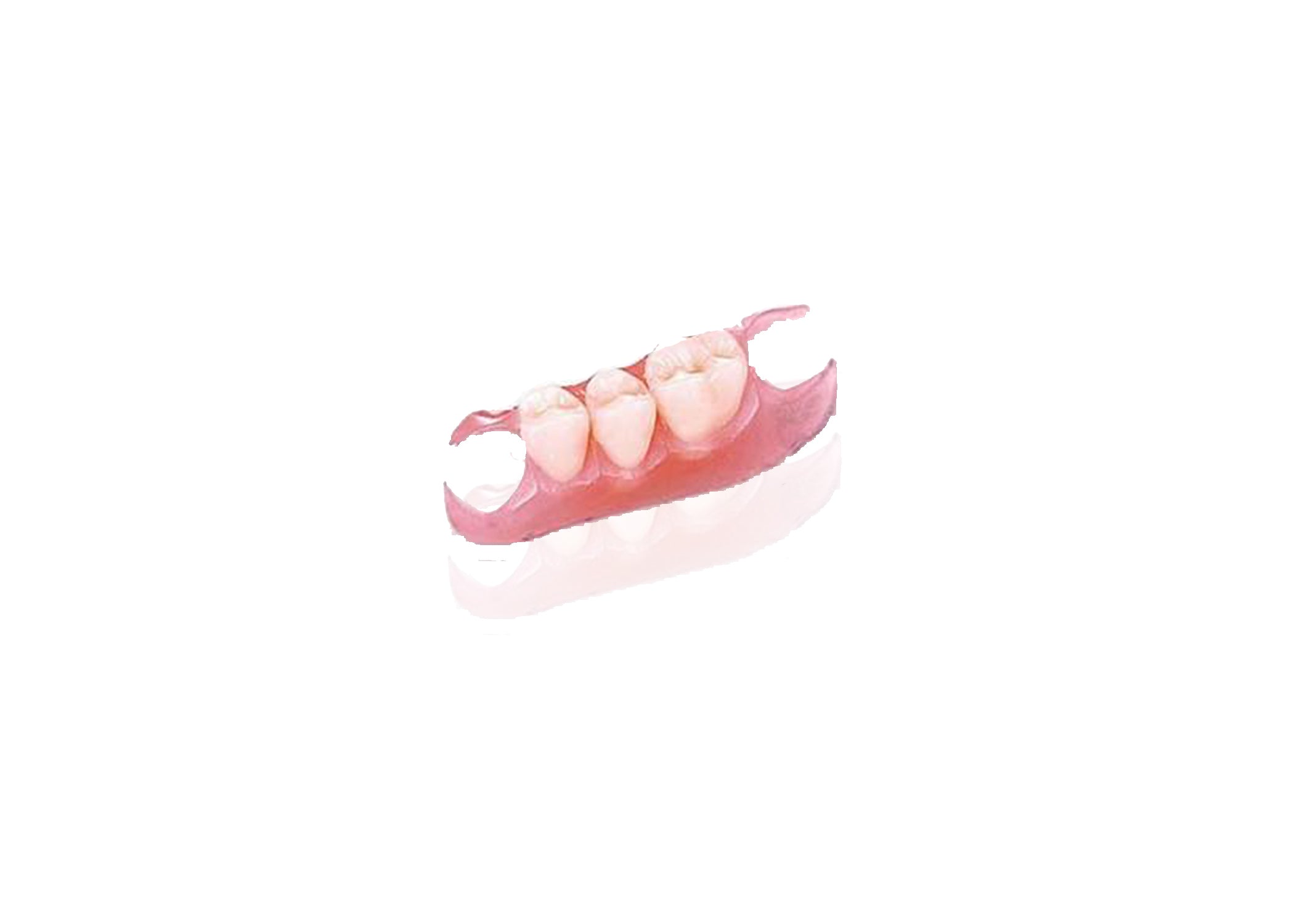 Valplast Rpd Generator Unilateral Valplast – Creative Dental Industries
