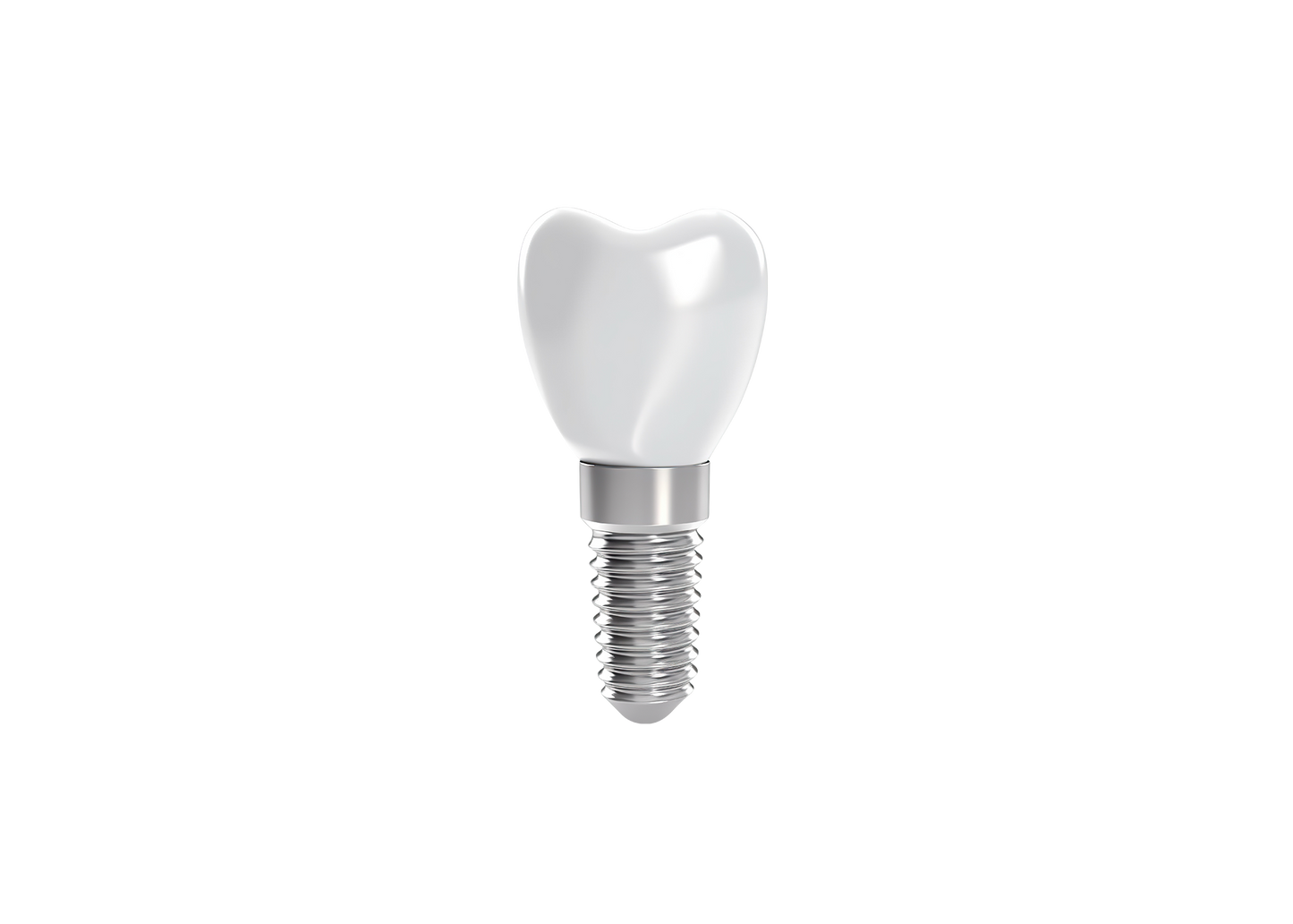 Titanium Abutment with PFM Crown