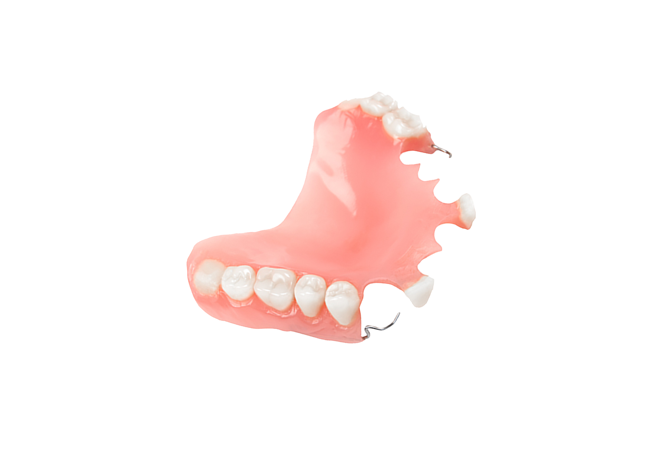 Stayplate (1-6 teeth) – Creative Dental Industries