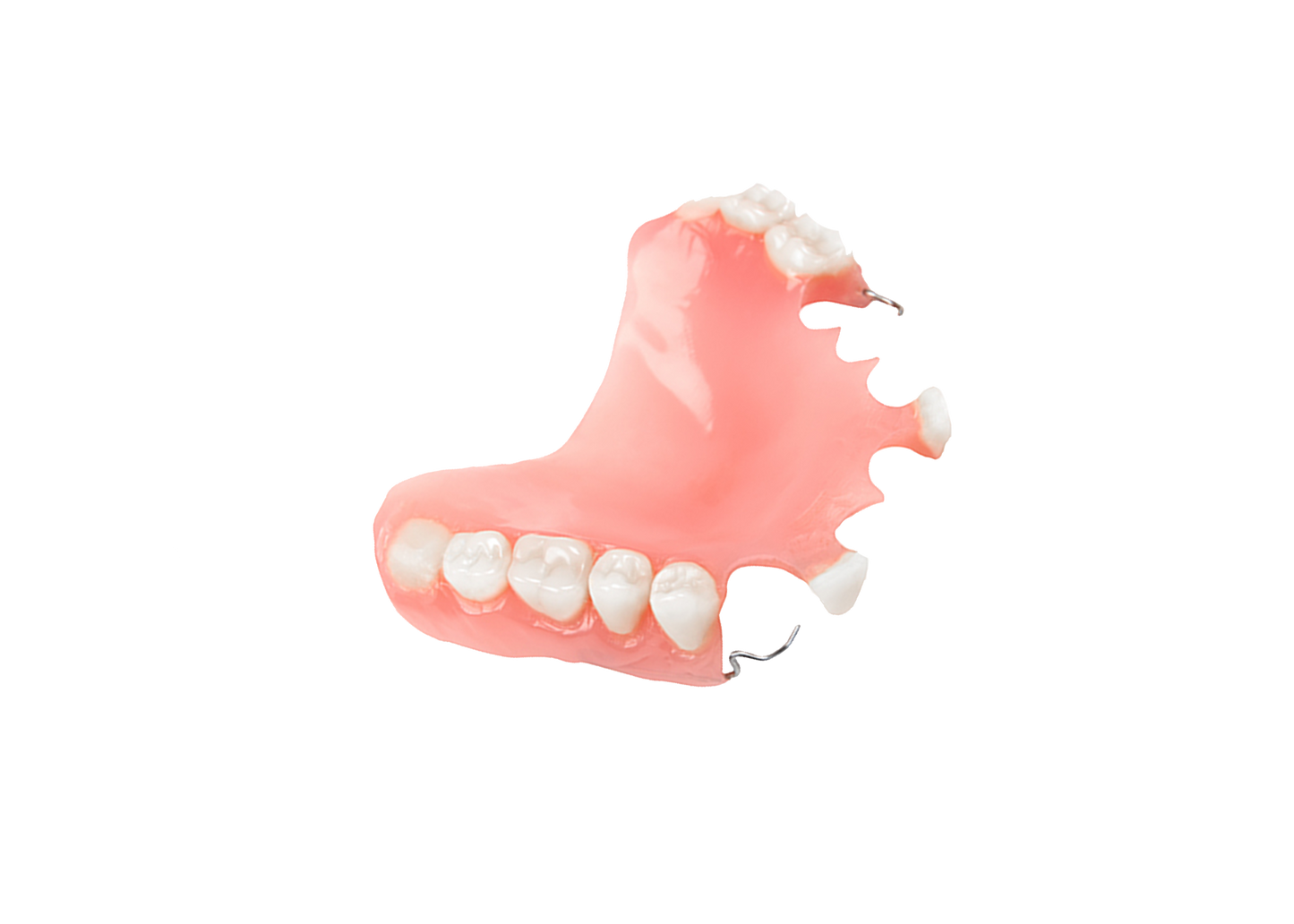 Stayplate (1-6 teeth)