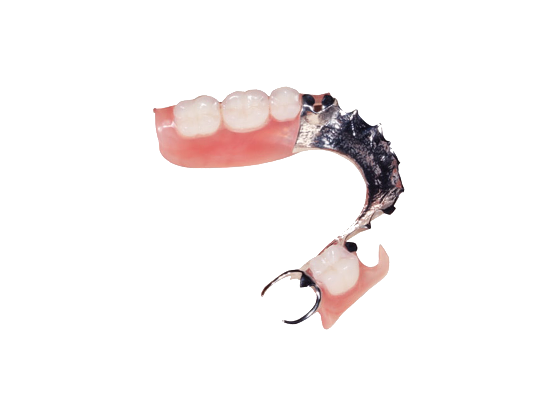 Valplast Rpd Generator Valplast with Metal Frame – Creative Dental Industries